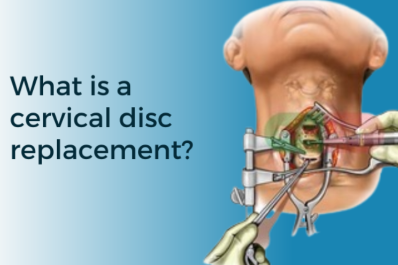 Cervical Disc Surgery