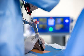 Endoscopic Spine Surgery In Nagpur