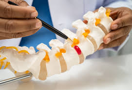 Microdiscectomy Surgery In Nagpur