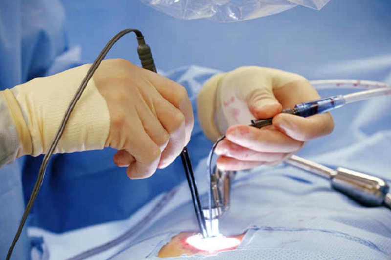 Minimal Invasive Spine Surgery