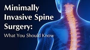 Minimally Invasive Spine Surgery In Nagpur