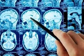Neuro Specialist In Amravati