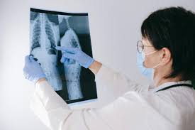 Spine Doctor in Katni