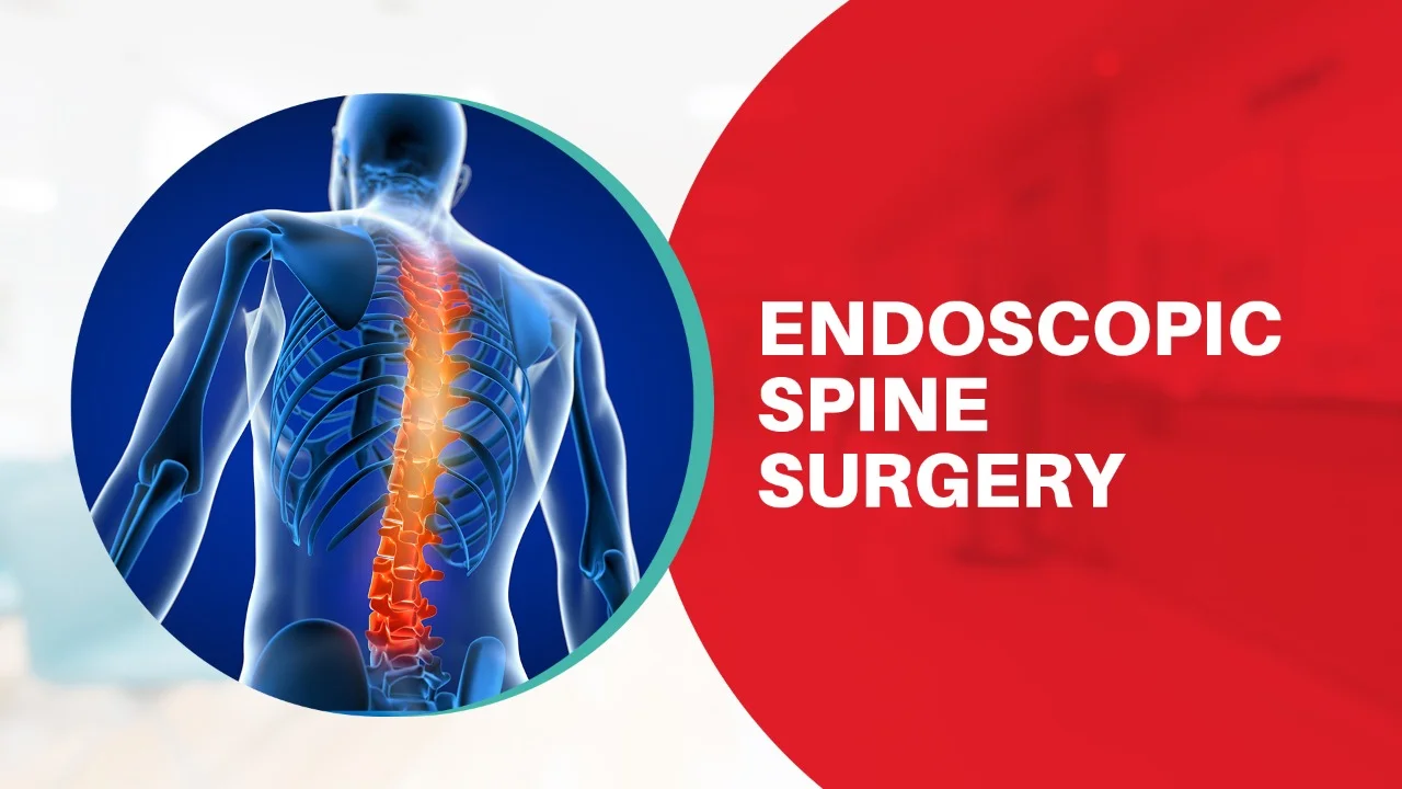 Endoscopic spine surgery