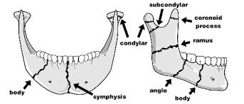 Fractures of Jaws and Facial Bones
