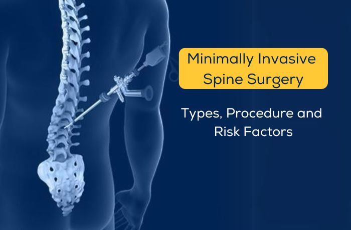Minimally invasive spine surgery