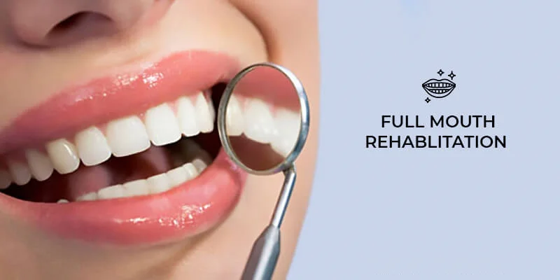 Full mouth rehabilitation
