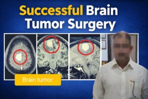 Successful brain tumor surgery