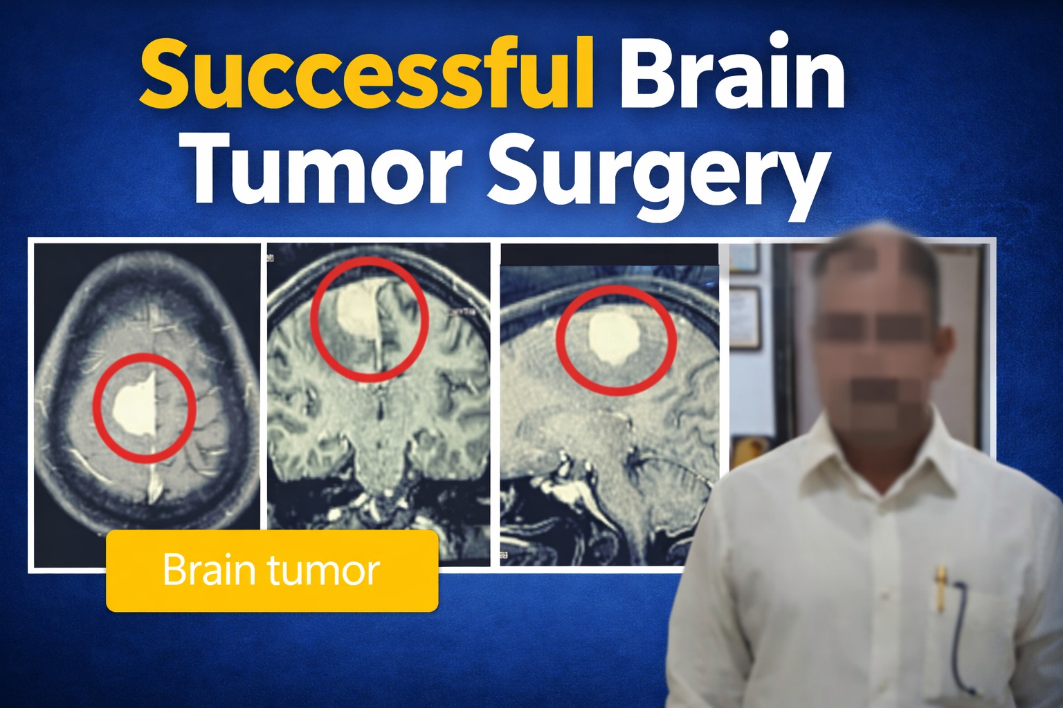 suceesful brain tumor surgery