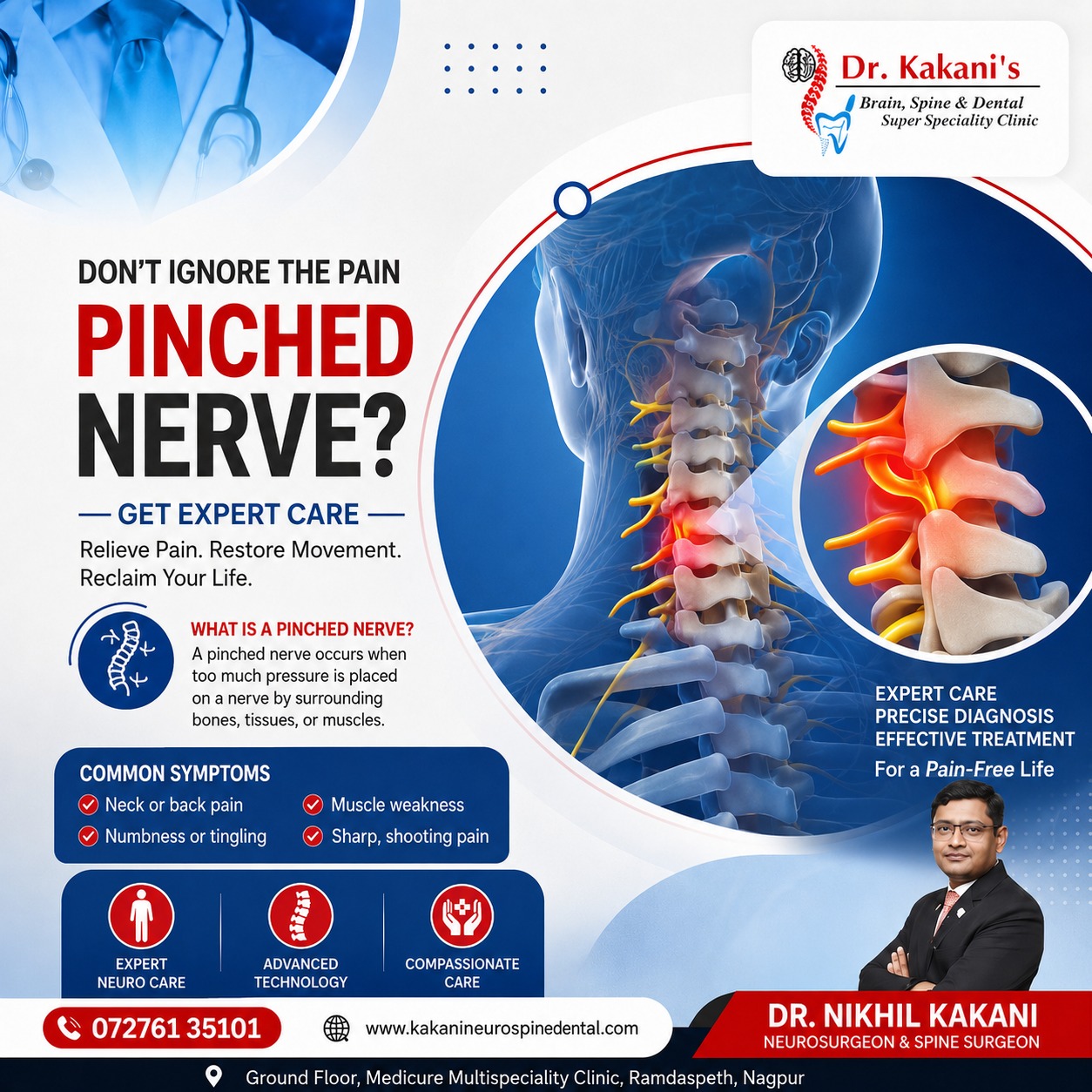 pinched nerve