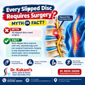 Does Every Slipped Disc Require Surgery? | Dr. Kakani