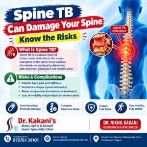 Spine TB: Symptoms, Causes, Diagnosis & Treatment