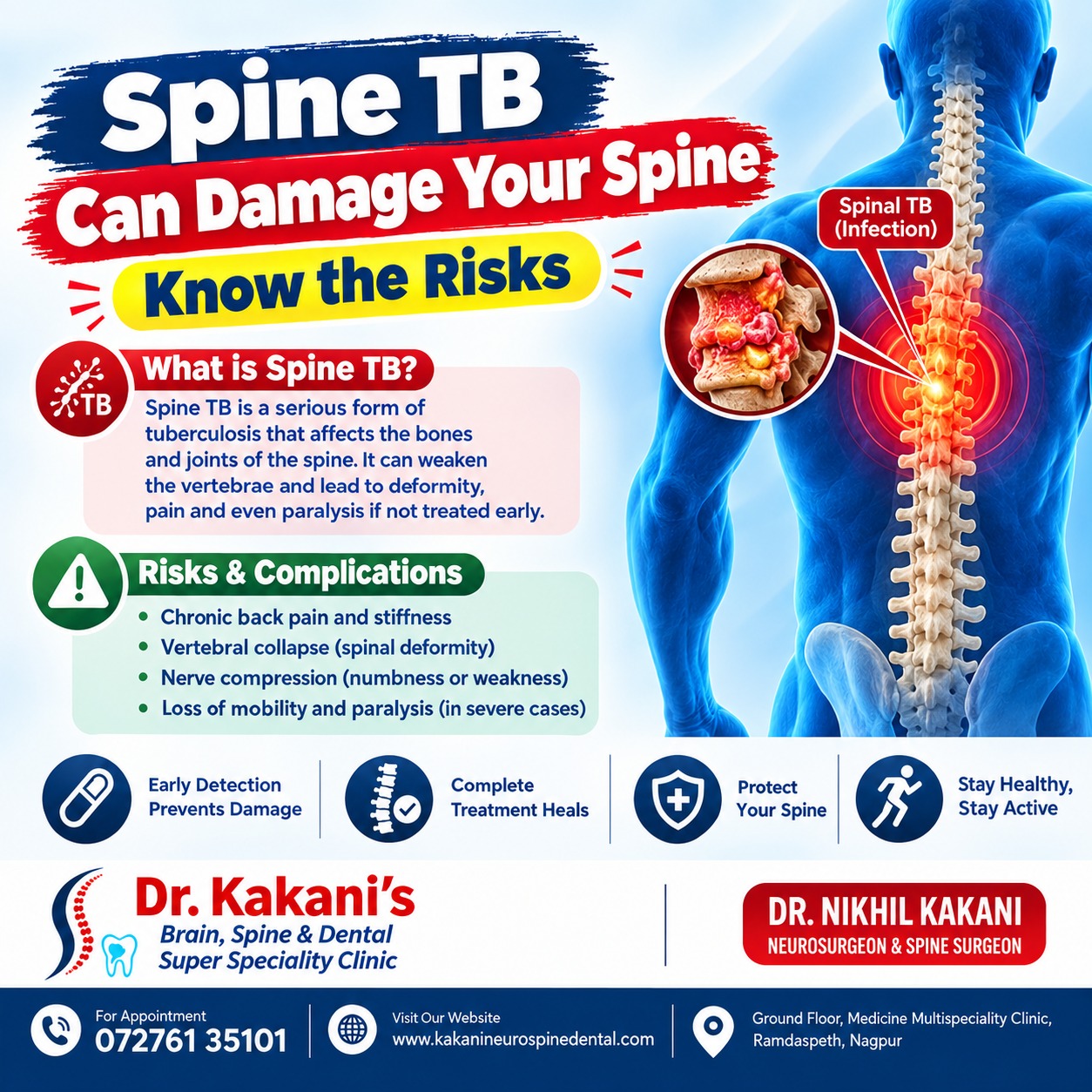 Spine TB: Symptoms, Causes, Diagnosis &amp; Treatment