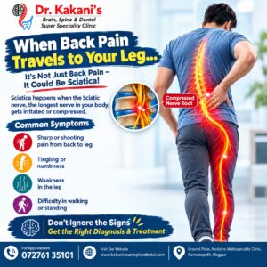 Sciatica Pain: Symptoms, Causes & Treatment