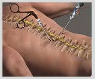 Affordable Spine Surgery In Nagpur