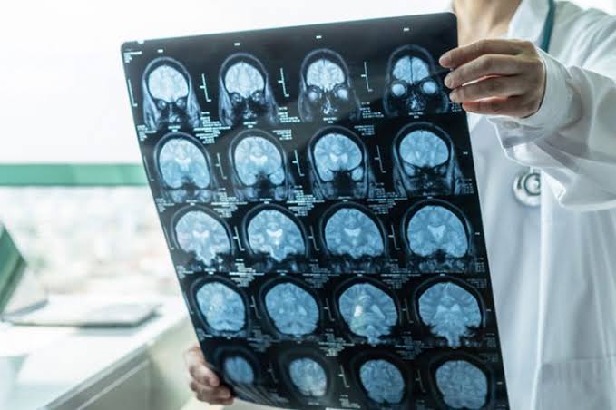 Neuro Specialist In Yavatmal