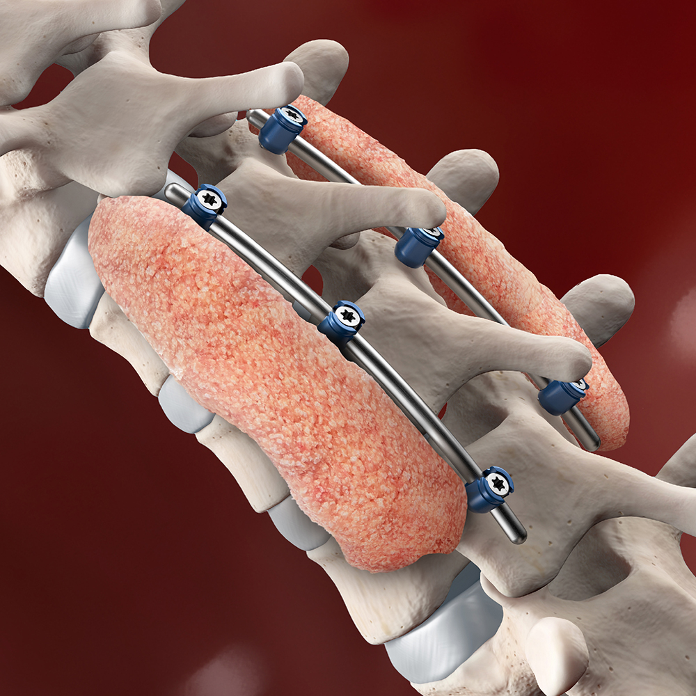 Spine Surgeon In Amravati