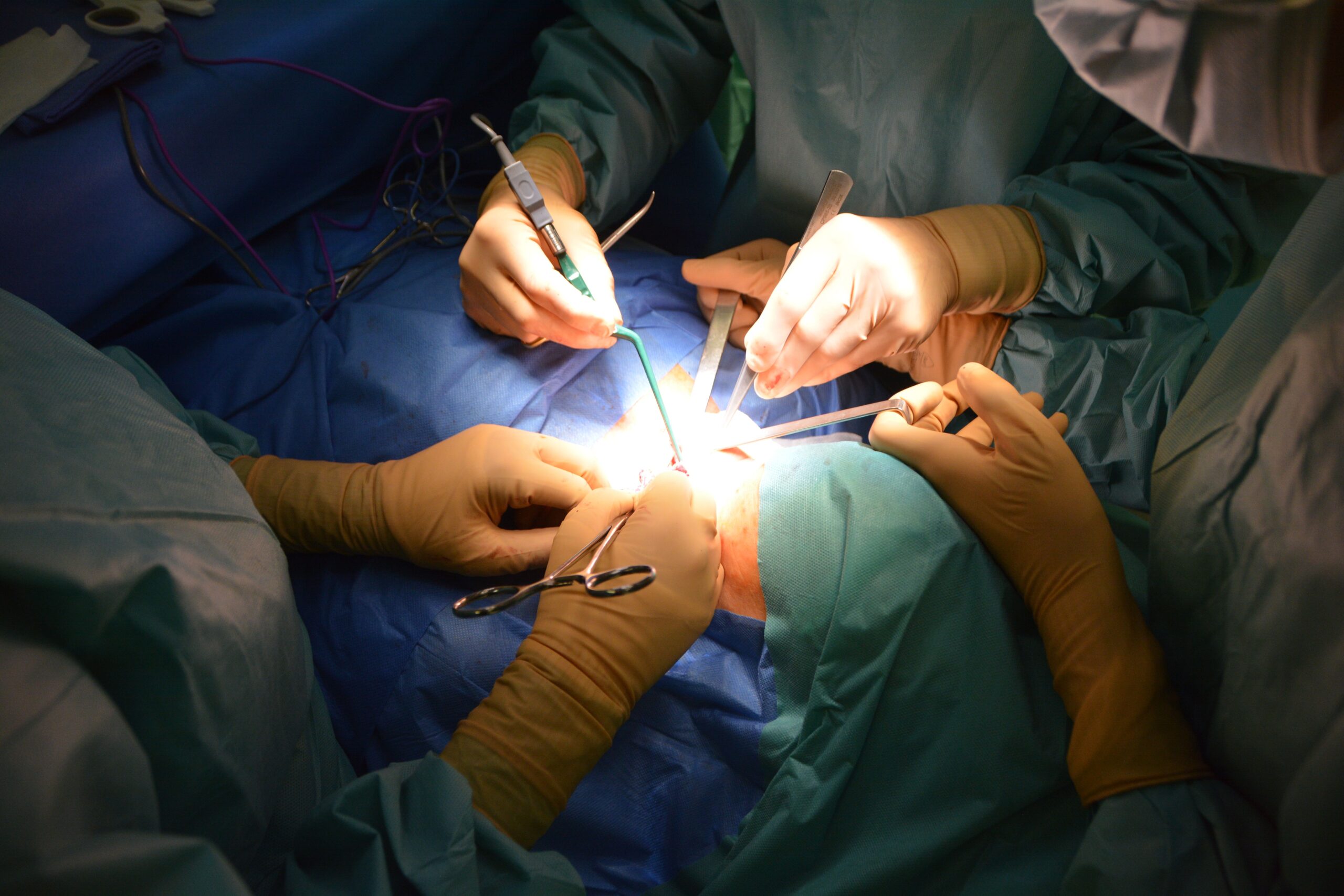 Microdiscectomy Surgery In Nagpur