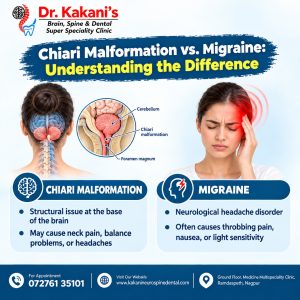 Chiari Malformation vs. Migraine: Understanding the Difference