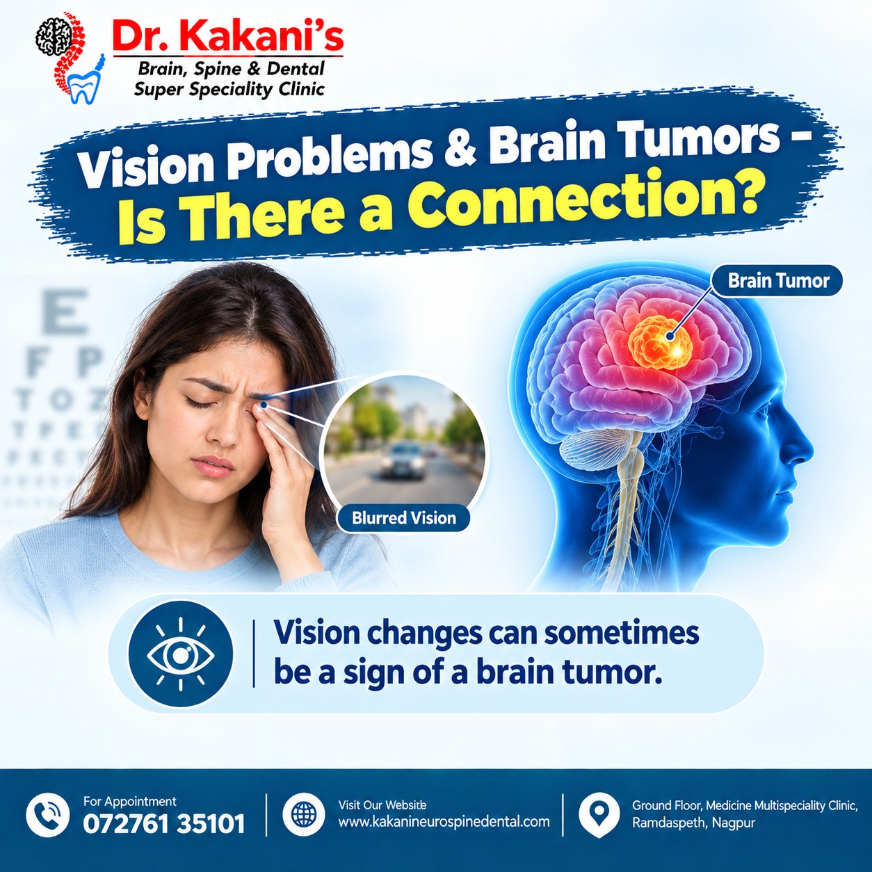 Vision Problems & Brain Tumors – Is There a Connection?