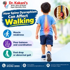 Spine Dysraphism and Walking