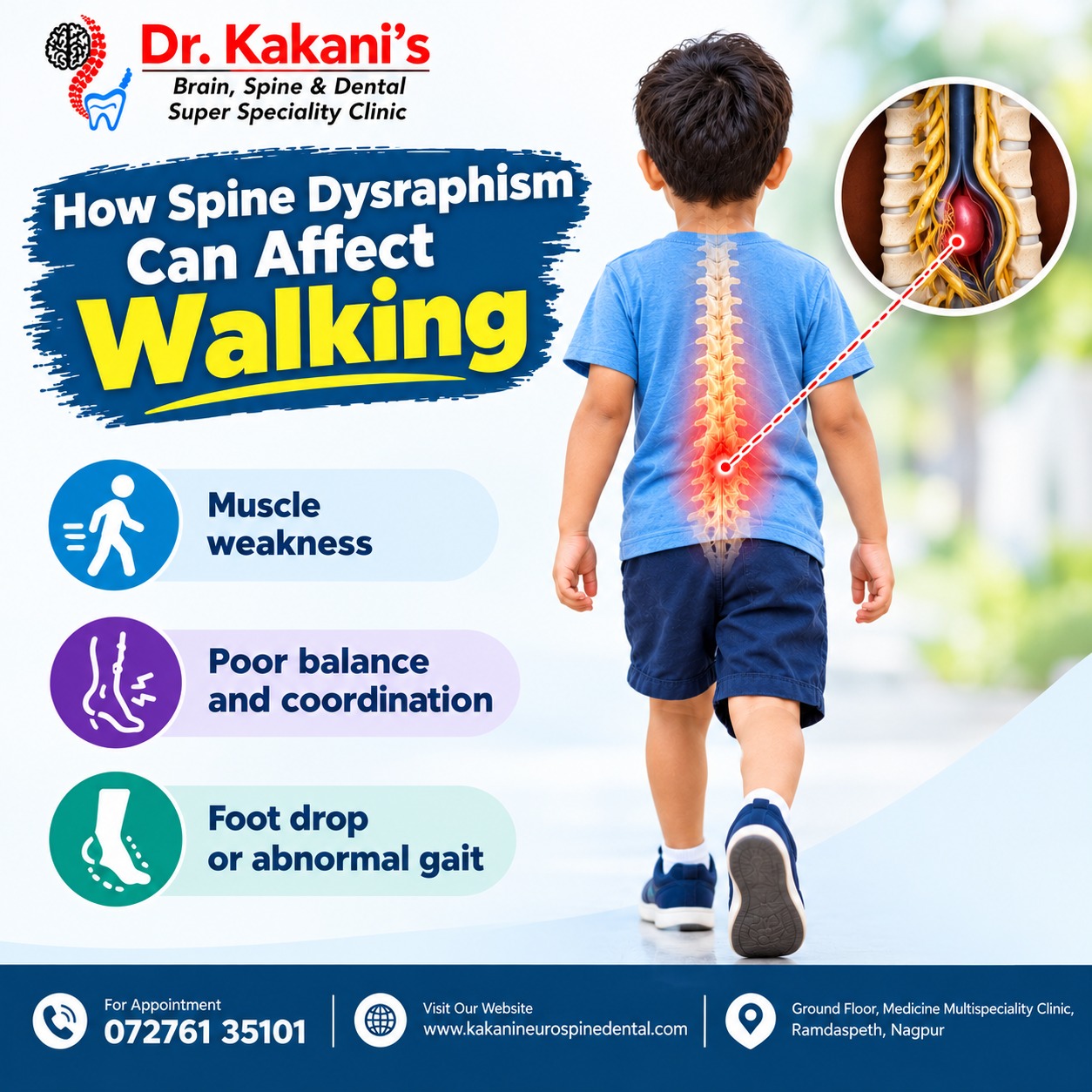 Spine Dysraphism and Walking