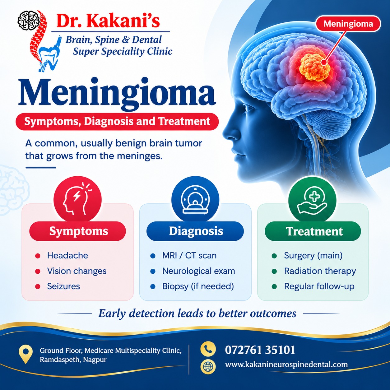 Meningioma Symptoms, Diagnosis & Treatment
