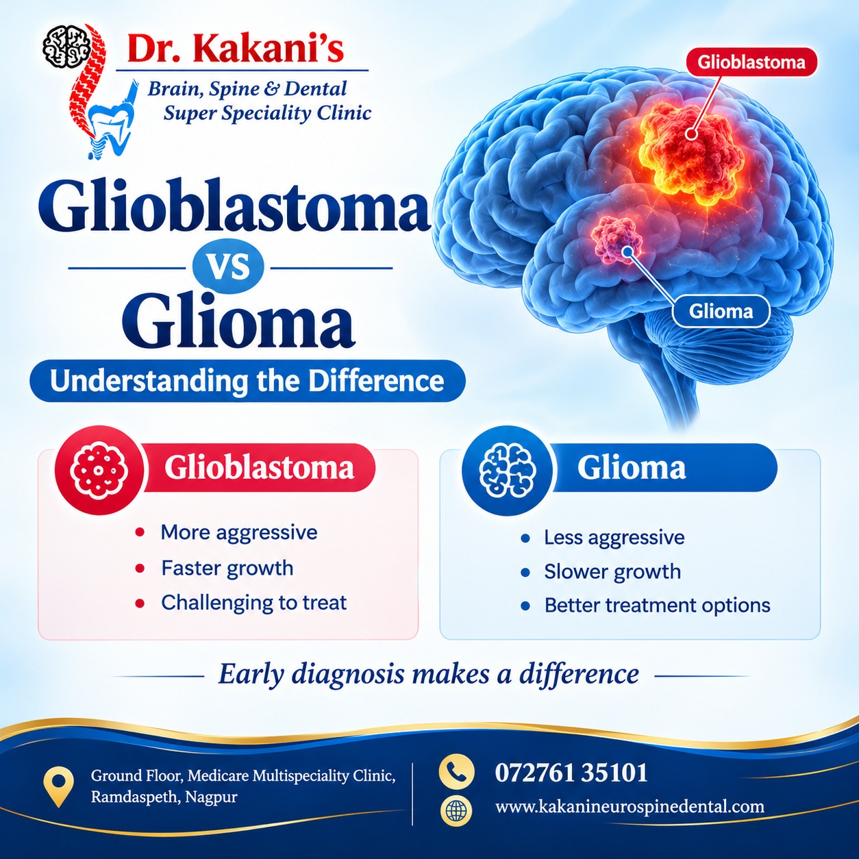 Glioblastoma vs Glioma Key Differences, Symptoms & Treatment