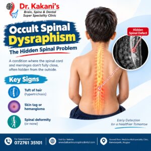 Occult Spinal Dysraphism: Symptoms, Diagnosis & Treatment