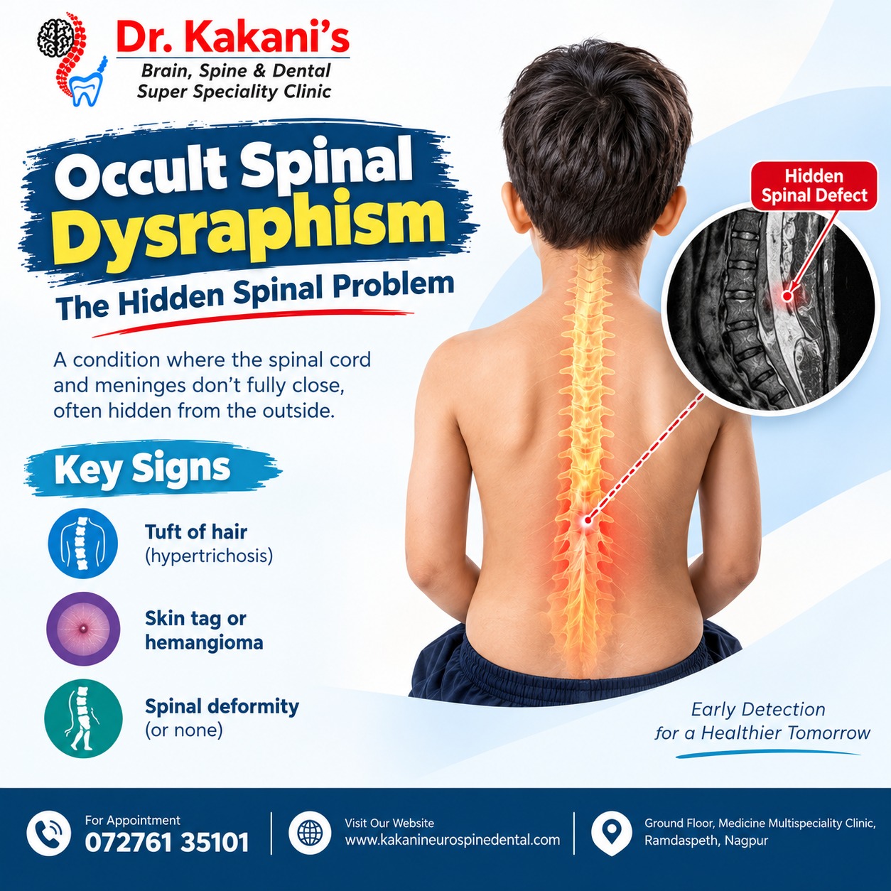 occtul spine